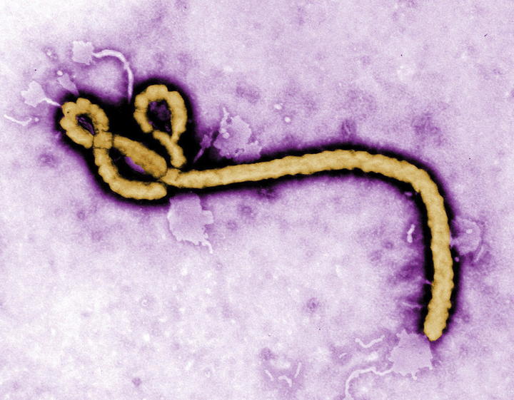 Detectan a otro paciente con síntomas de ébola en Dallas