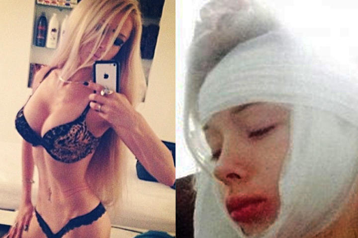 Desfiguran rostro a la 'Barbie humana'