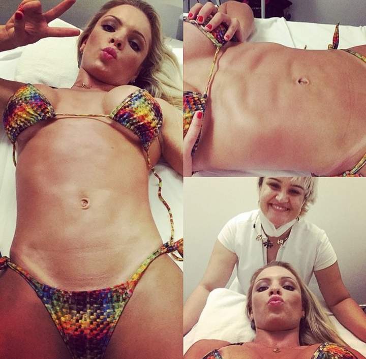 Miss Bumbum se somete a polémica operación