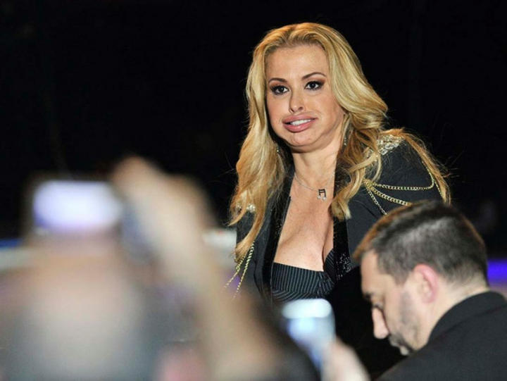 Cantante desata polémica con sus labios