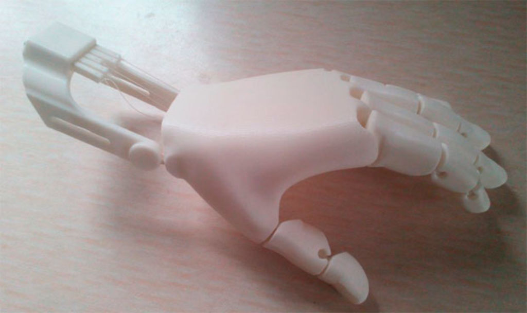 Prótesis de bajo costo con impresoras 3D