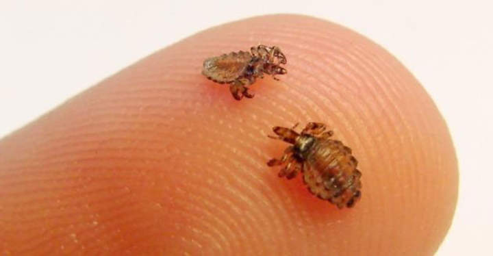 Piojos o pediculosis de la cabeza