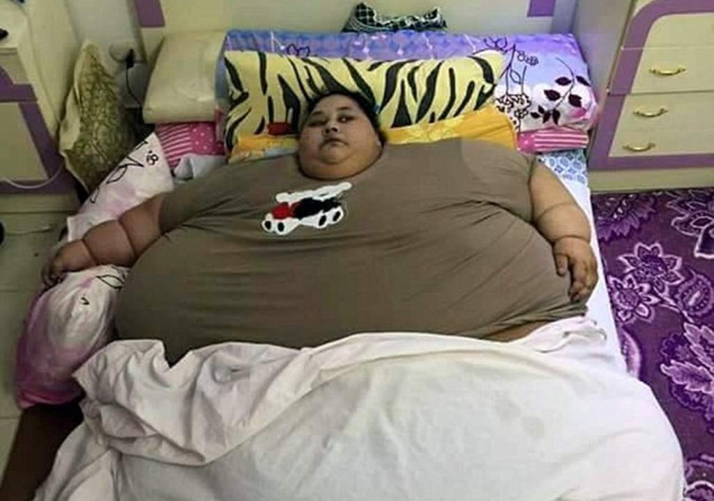 La mujer más gorda del mundo pesa 500 kilos
