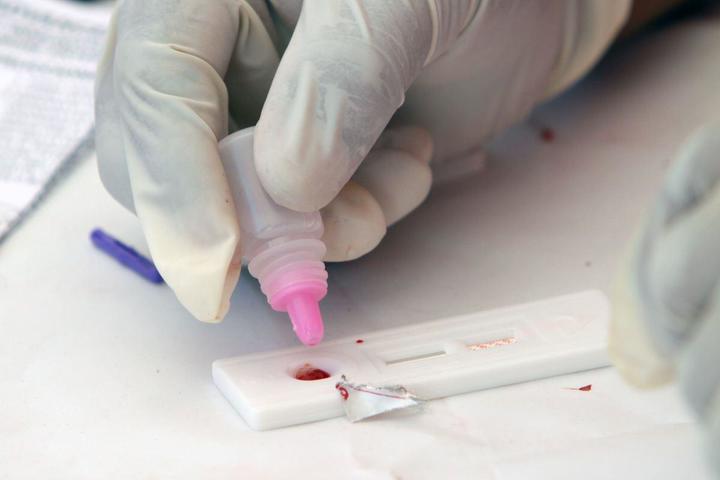 Atiende Tlaxcala a 700 pacientes con VIH-Sida