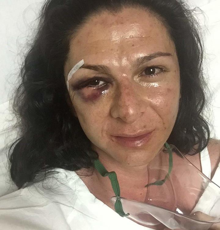 Golpean a Ana Gabriela Guevara