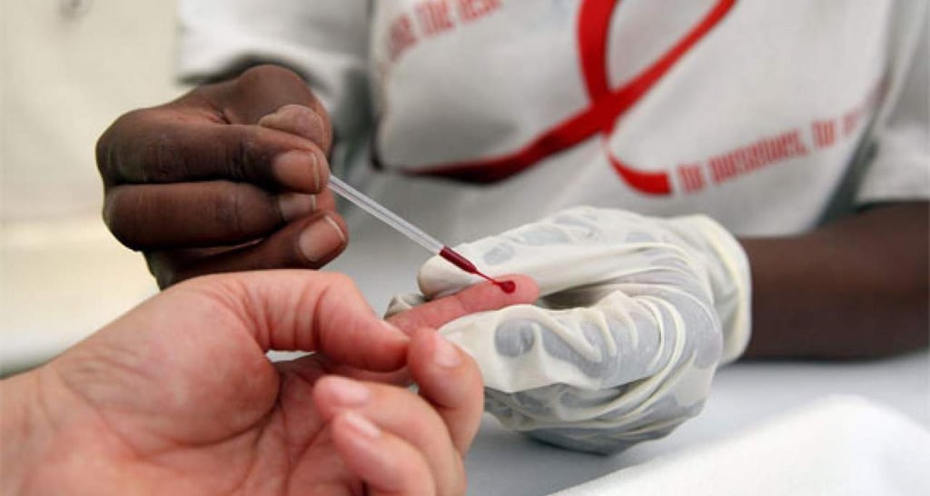 Reducen casos de VIH en Estados Unidos