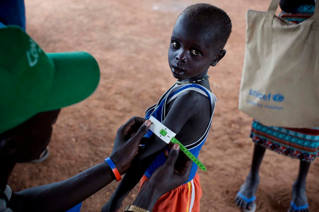 Declara ONU estado de hambruna en Sudán del Sur