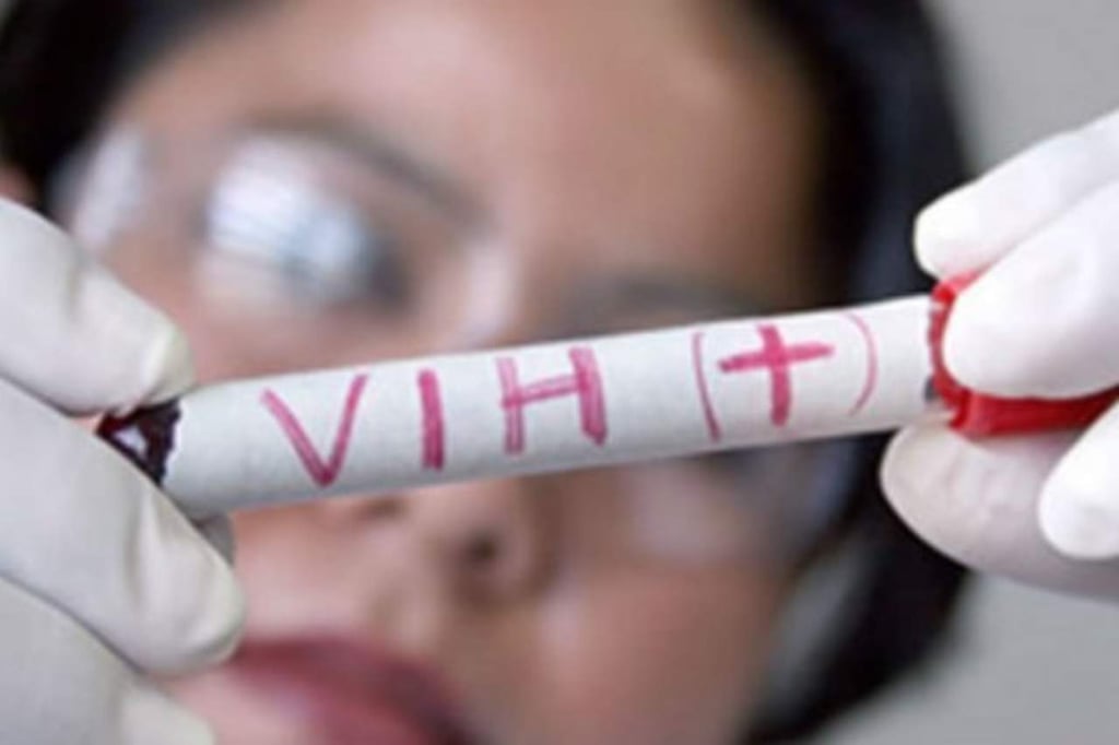 Ensaya Cuba vacuna para enfermos de SIDA