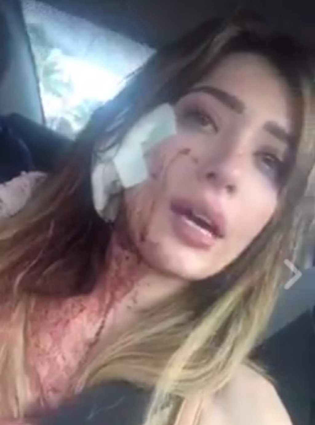 Denuncia Brenda Zambrano de 'Aca Shore' que fue golpeada en antro