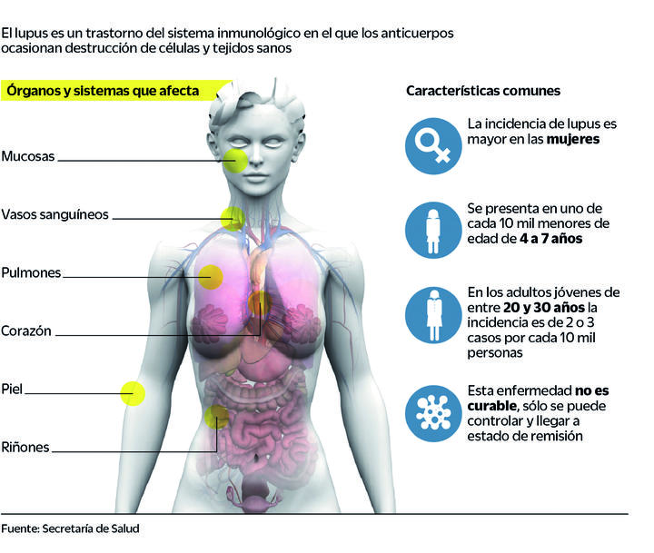 Lupus. La enfermedad de la mariposa