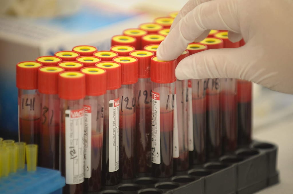 Nanopartículas para revolucionar los análisis de sangre