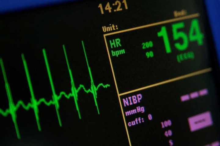 Datos sobre el ritmo cardíaco