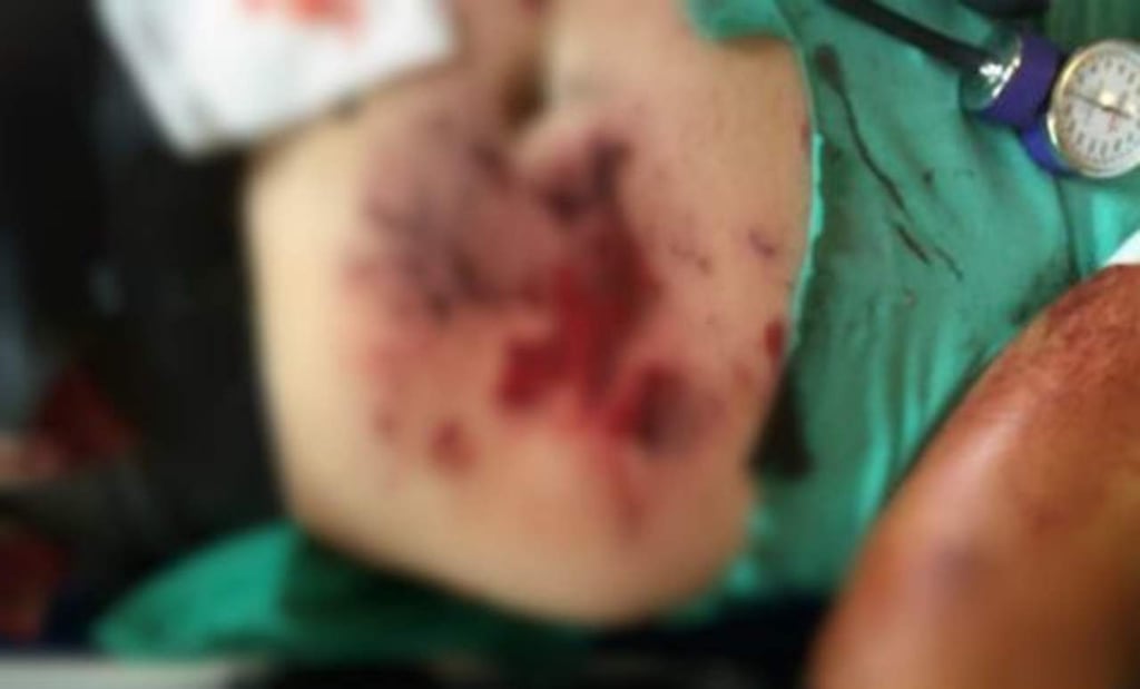 Explota 'caja de galletas' y lesiona a un hombre en CDMX