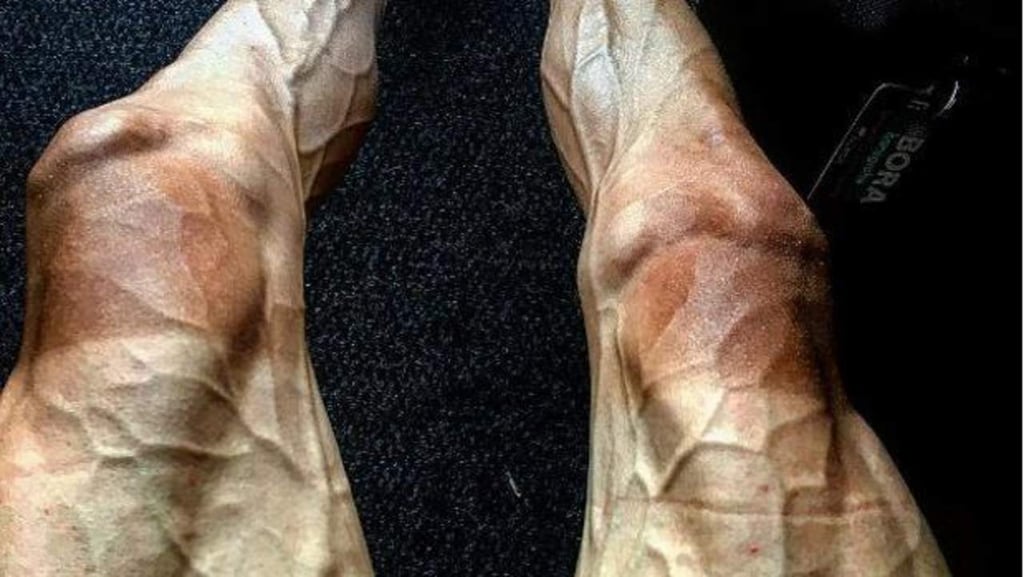 Increíble estado de piernas de ciclista en el Tour de Francia