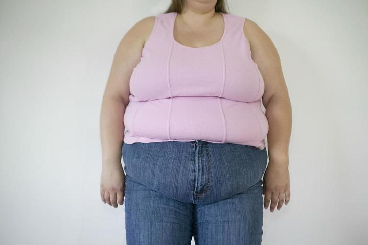 Tres mil mujeres presentan obesidad