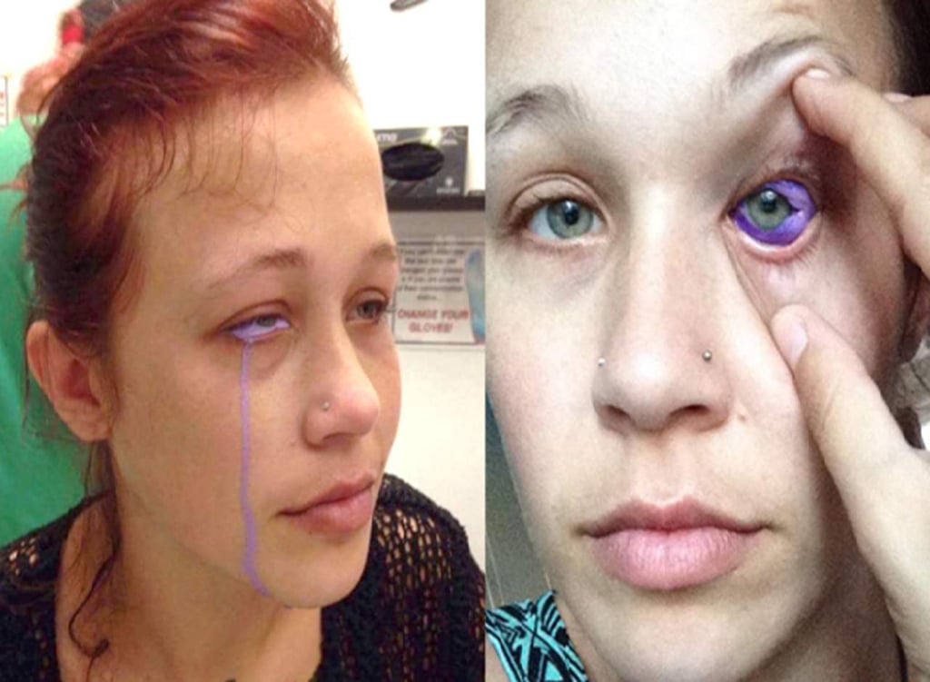 Tatuaje de ojos mal hecho manda a una modelo al hospital