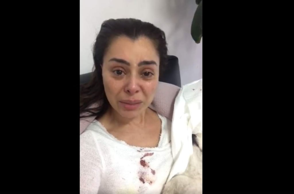 Yadhira Carrillo llora por la muerte de su perro