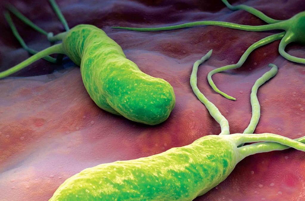 Cómo prevenir la helicobacter pylori