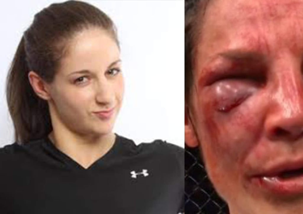 Este es el rostro del antes y después de una luchadora de UFC