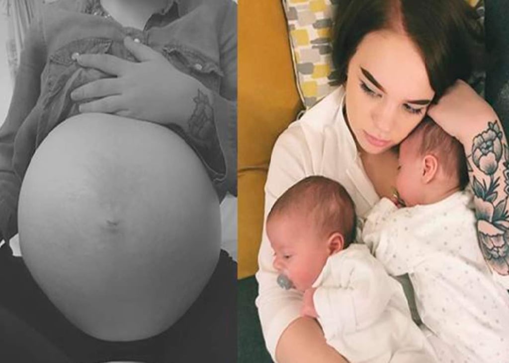 Madre de gemelos muestra con orgullo sus estrías del embarazo