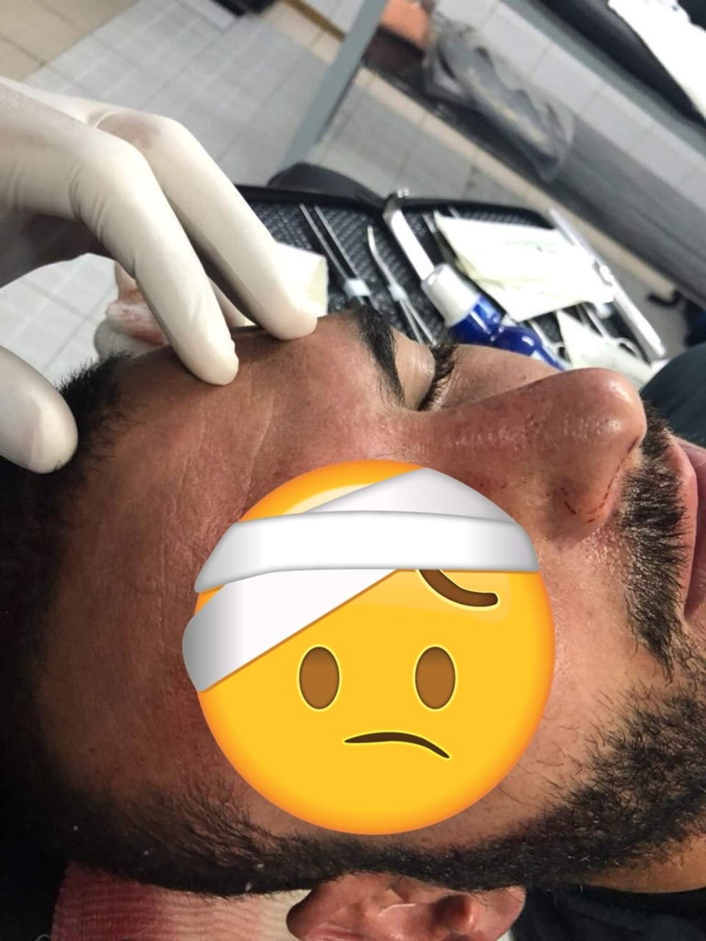 Así quedó el corte en la ceja del portero Álvarez