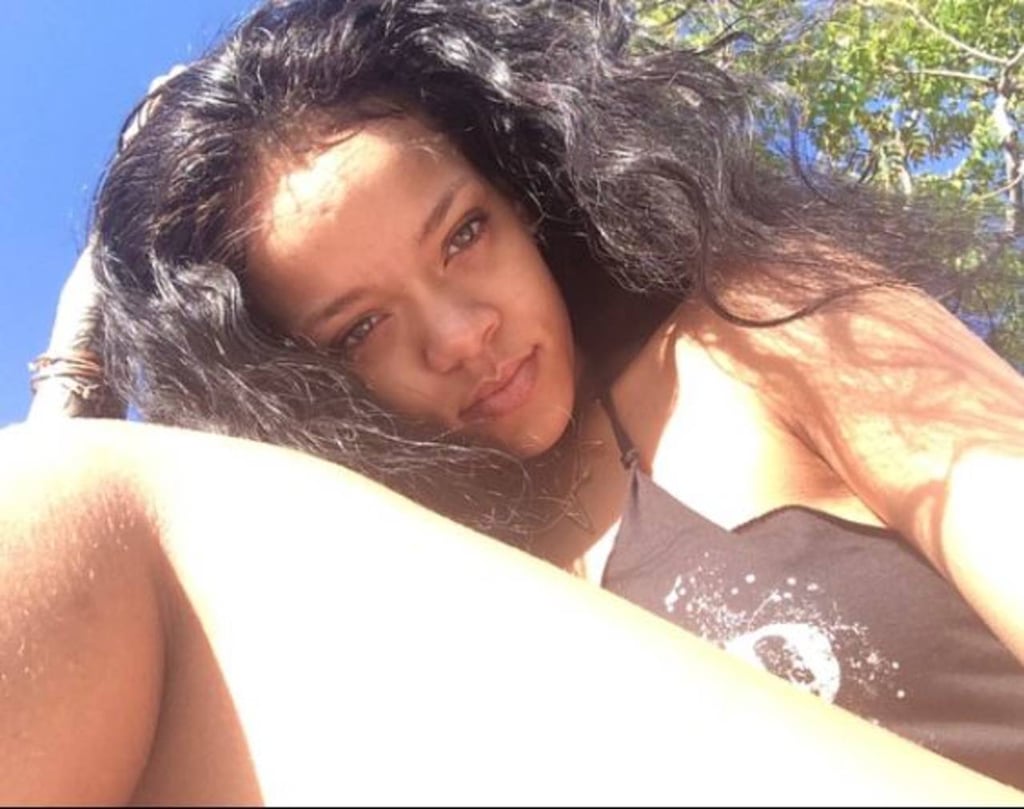 Rihanna muestra estrías y vellitos