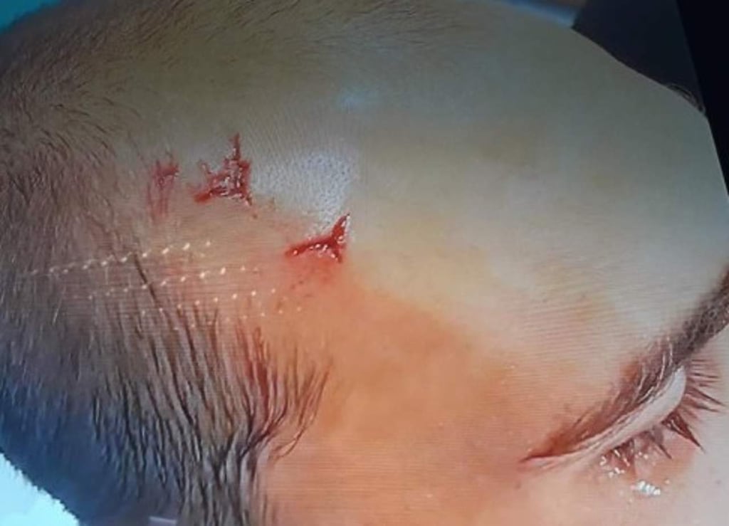 Hinchas agreden a jugadores de Sporting Lisboa