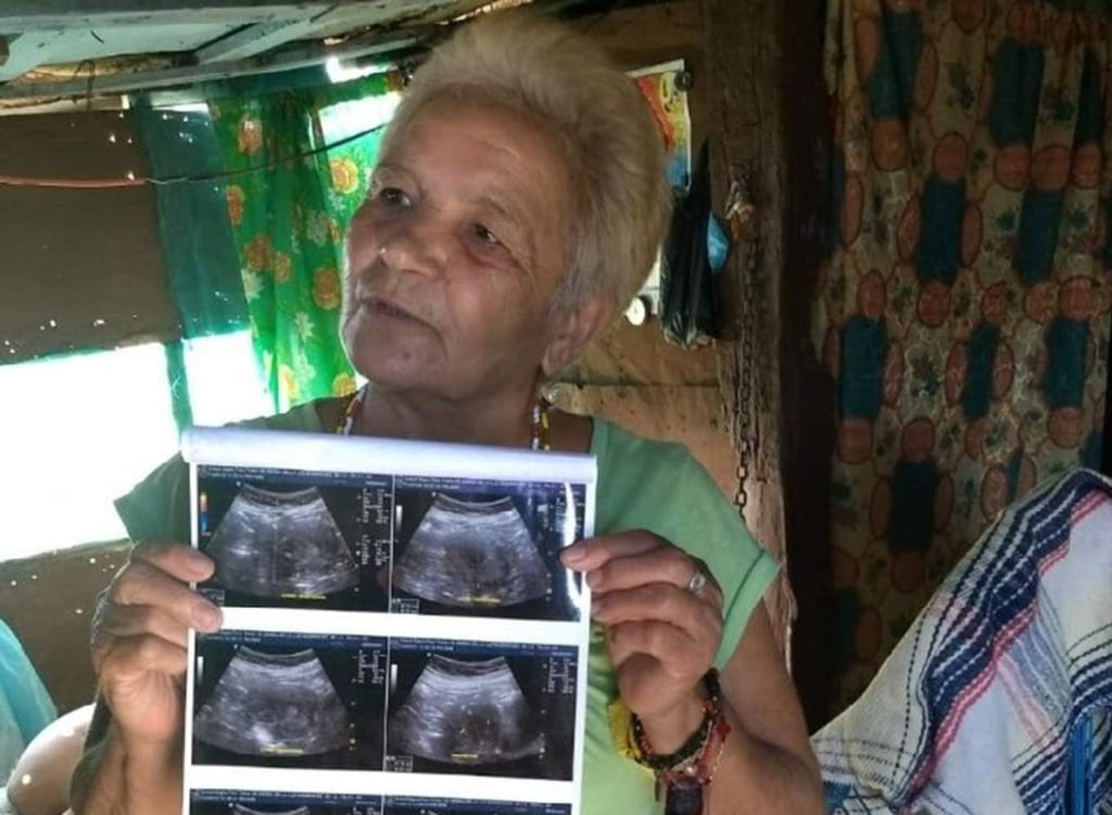 Mexicana de 70 años asegura estar embarazada