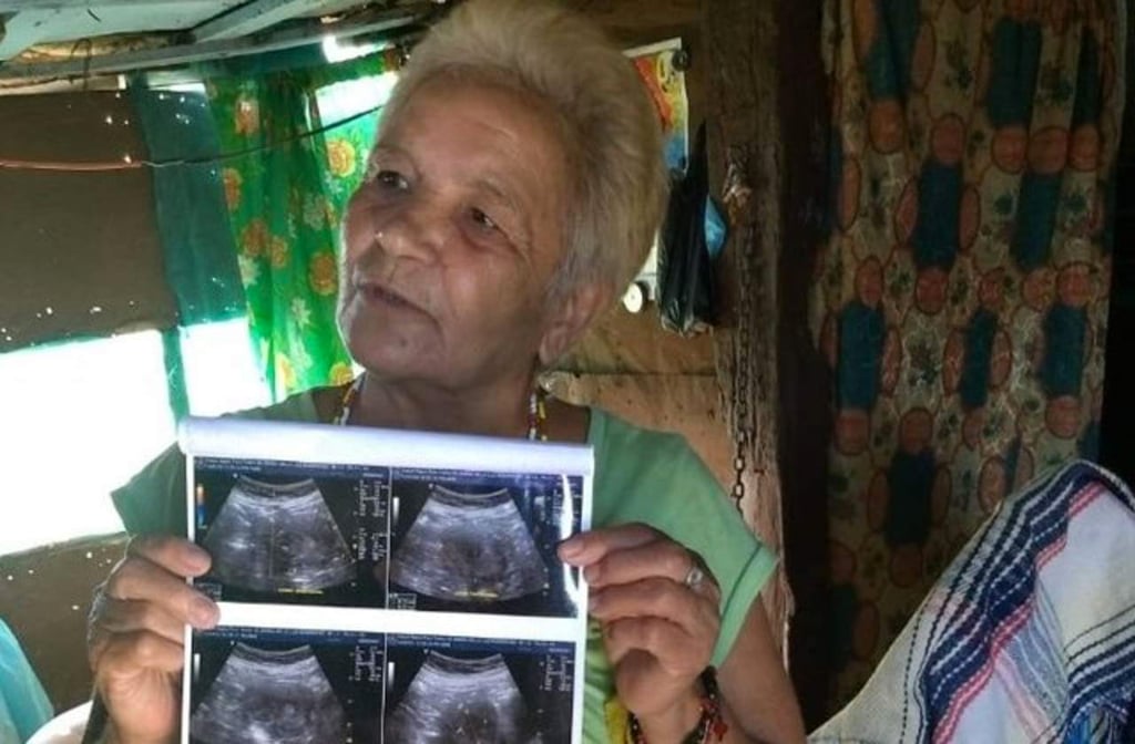 Asegura mujer de 71 años estar embarazada en Mazatlán