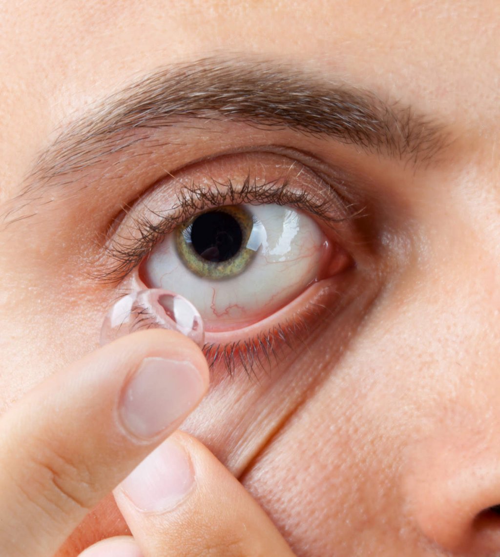 Tecnología permite que lentes de contacto resuelvan problemas visuales