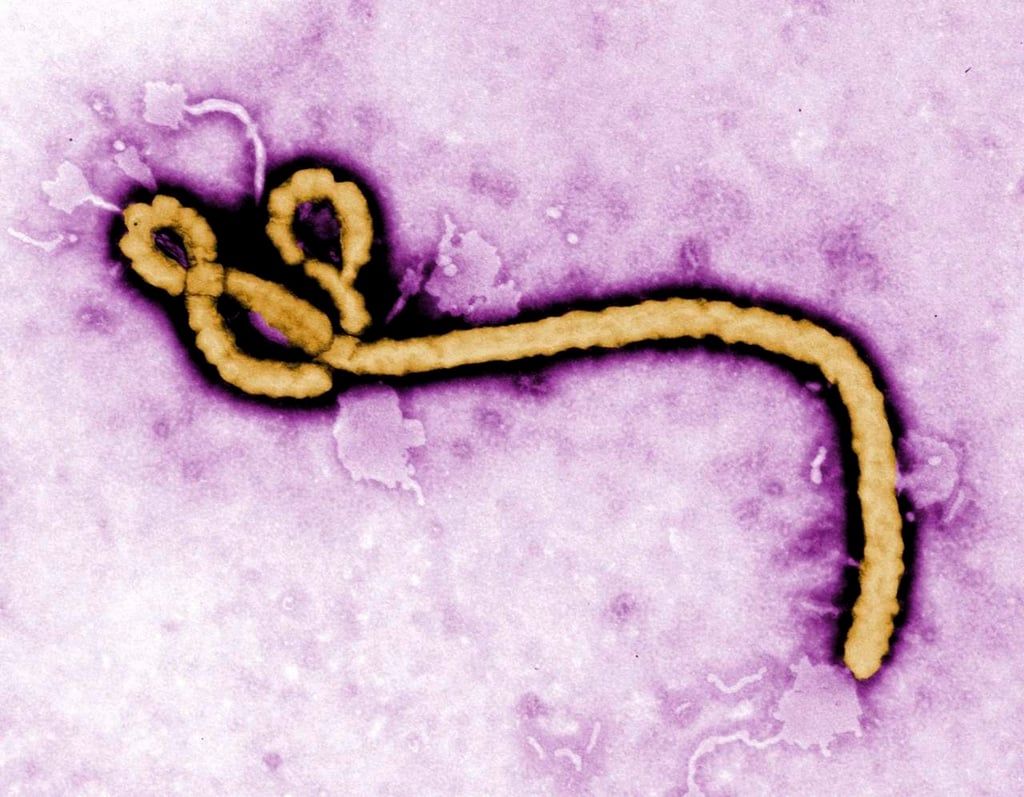 Sobrevivientes al ébola generan anticuerpos especiales contra el virus