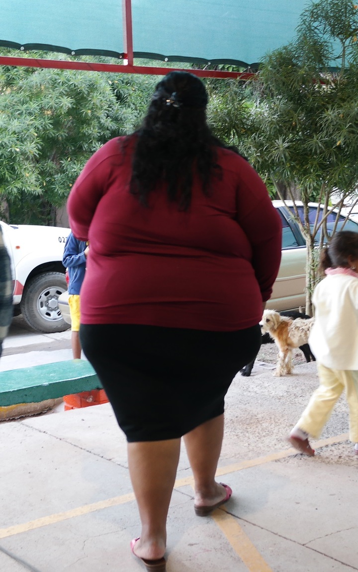 Registran 24 casos diarios de obesidad, promedio