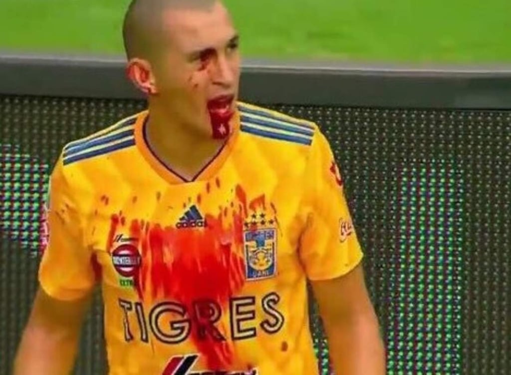 VIDEO: Momento del codazo a Torres Nilo