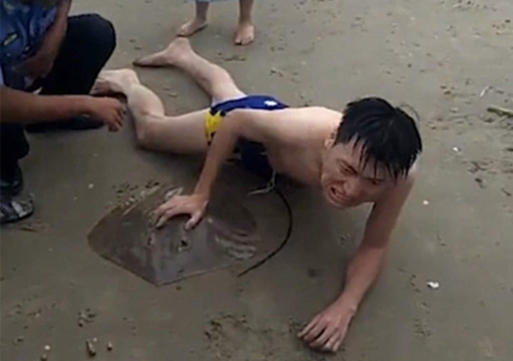 VIDEO: Sujeto sufre agónica picadura de mantarraya