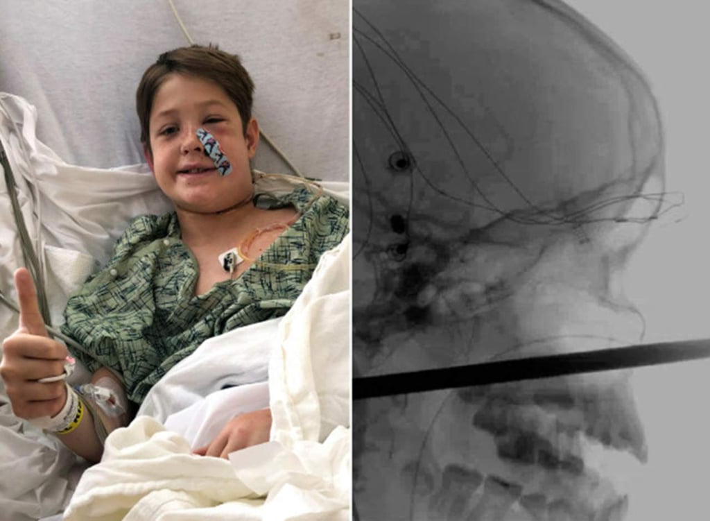 La increíble historia del niño que sobrevivió pese a todo pronóstico