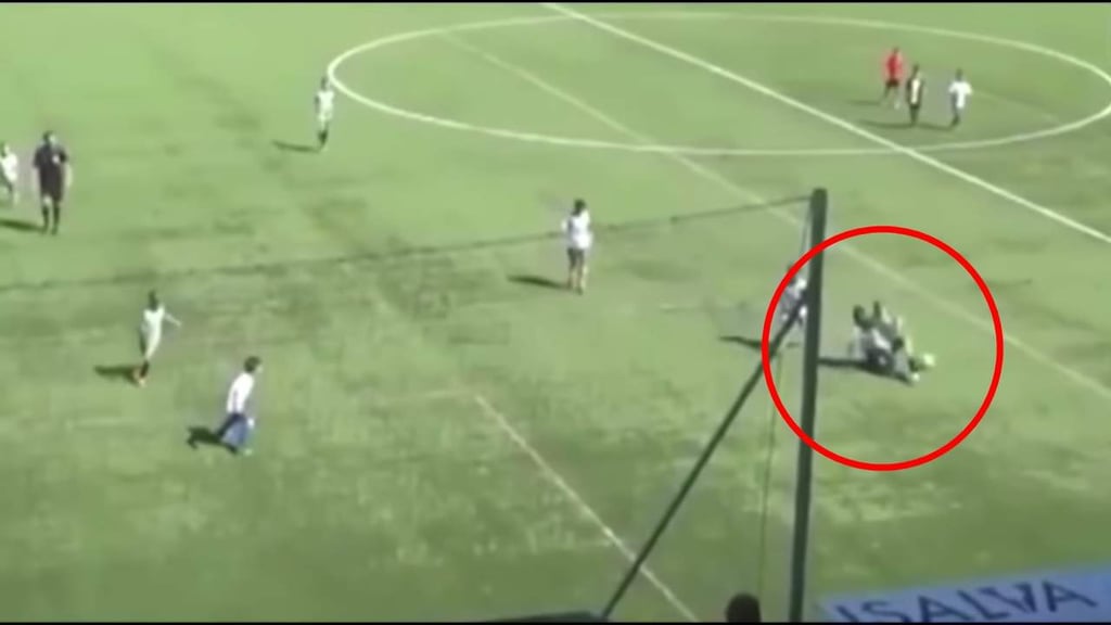 Escalofriante lesión a niño de tibia y peroné al que acusan de simular