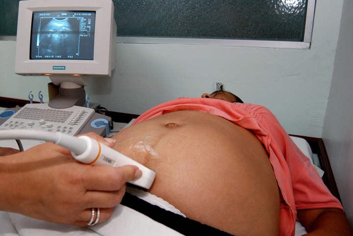 Rebasadas, muertes maternas de 2017