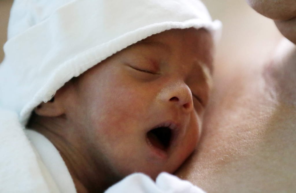 Investiga Francia serie de casos de bebés nacidos sin brazos