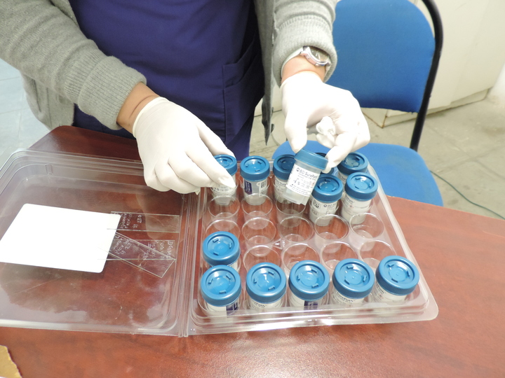 Ofrecen estudio para detectar VPH