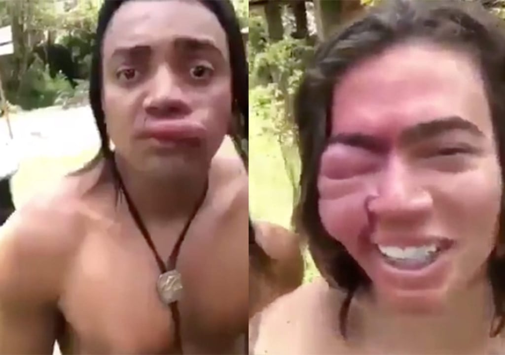 Se hacen virales al grabarse tras ser atacados por abejas