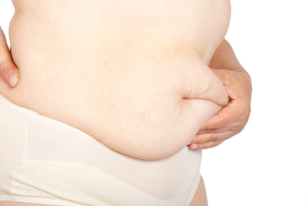 Genes determinan dónde se acumula la grasa en el cuerpo
