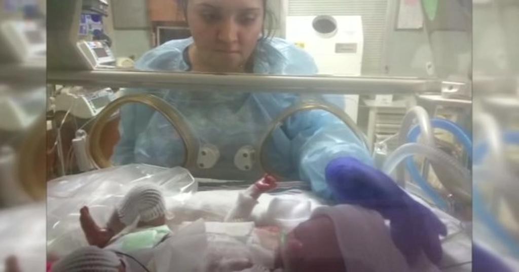 Sin diagnóstico, bebé que nació sin piel en San Antonio