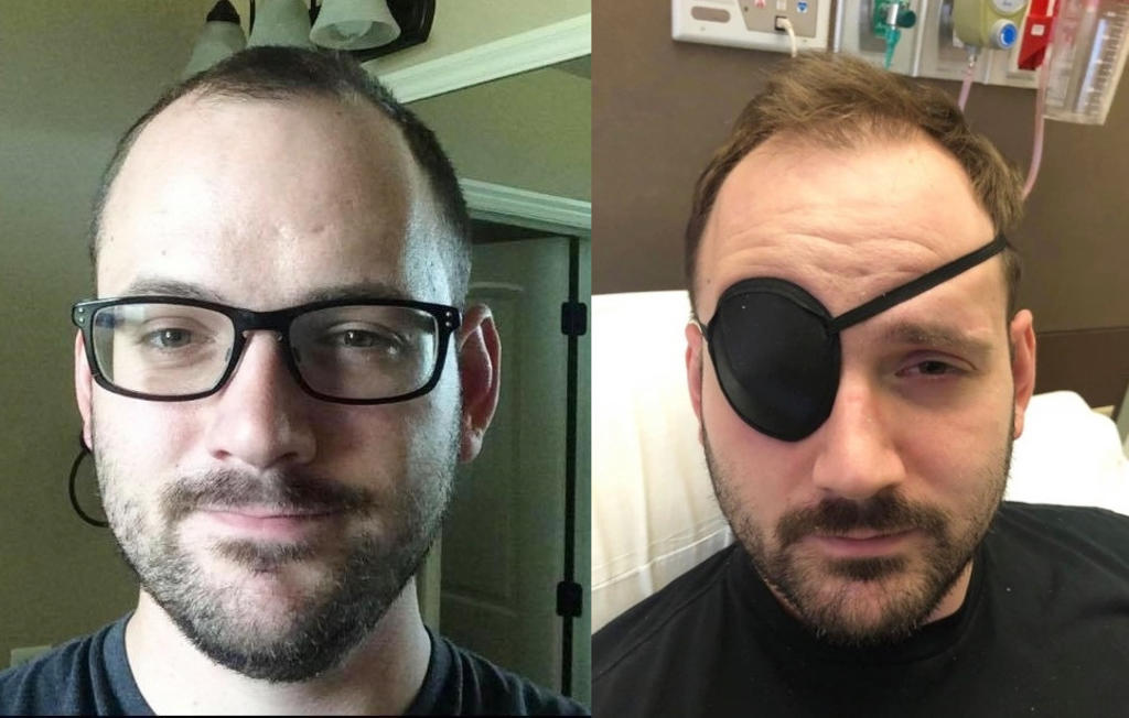 Sufre derrame cerebral por tronarse el cuello