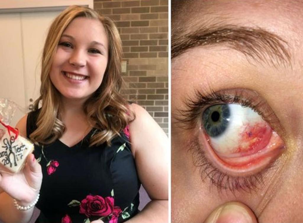 Le operaban el ojo equivocado y luego corrigieron pero sin anestesia