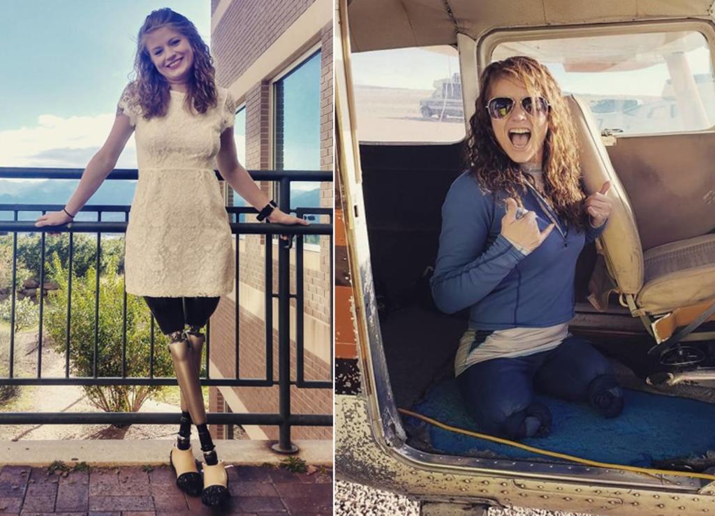 Joven que perdió las piernas lo toma con humor e inspira a otros