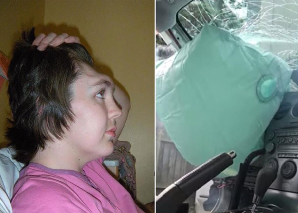 Video explica por qué no se deben poner los pies en el tablero del auto