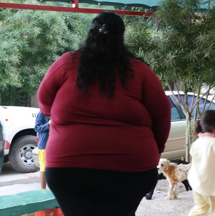 En mujeres, 66% de casos de obesidad