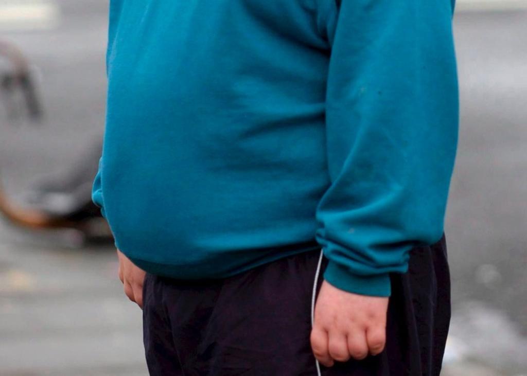 Obesidad infantil genera riesgos de salud en edad adulta