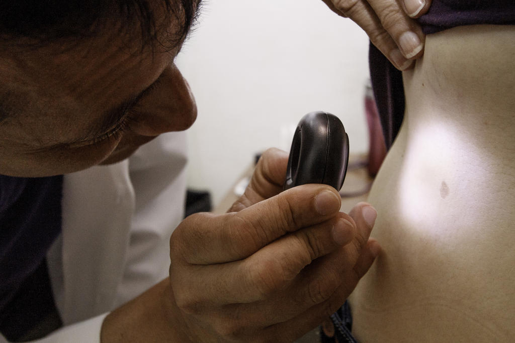 México carece de estadísticas confiables sobre cáncer de piel