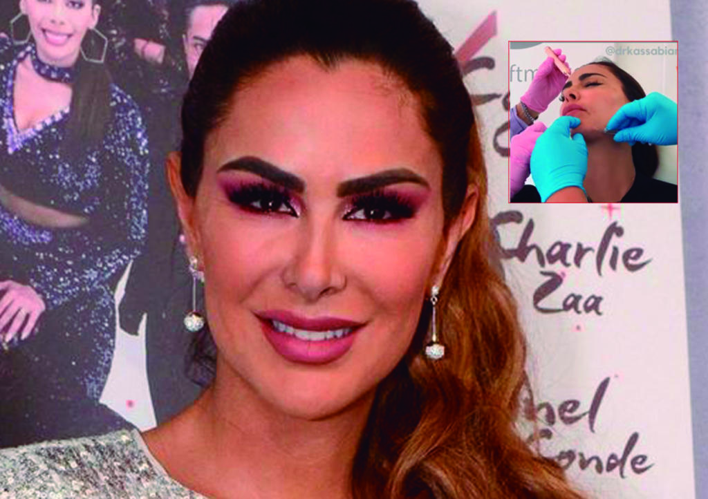 Difunden video de Ninel Conde poniéndose botox